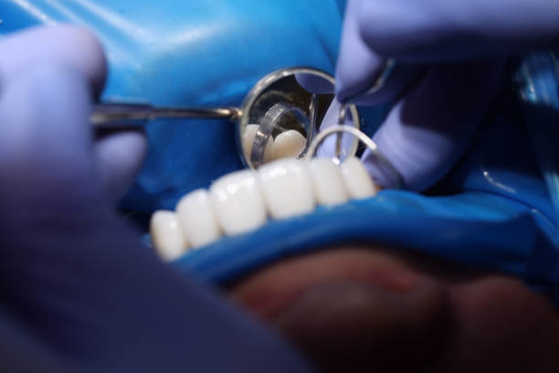 Oral Surgery at Ewing Dental Group in Ewing, NJ