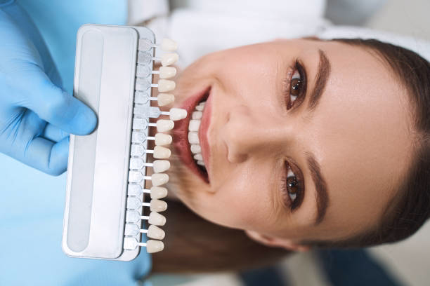 Teeth Whitening & Veneers at Ewing Dental Group in Ewing, NJ