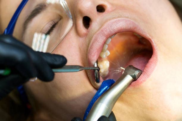 Root Canal Specialists at Ewing Dental Group in Ewing NJ